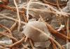 La désinfection finale des maladies fongiques Comment nettoyer les cabines du lichen