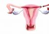 Si të mbeteni shtatzënë pa tubat fallopiane