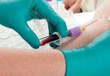 Biokemijski test krvi pokazuje onkologiju Biokemijski test krvi pokazuje rak ili ne